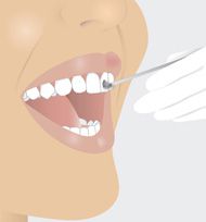 Zähne werden fluoridiert