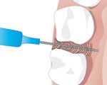 Eine Interdentalzahnbürste